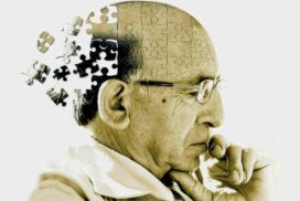 04-alzheimer