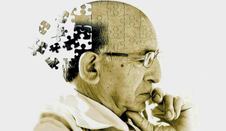 04-alzheimer